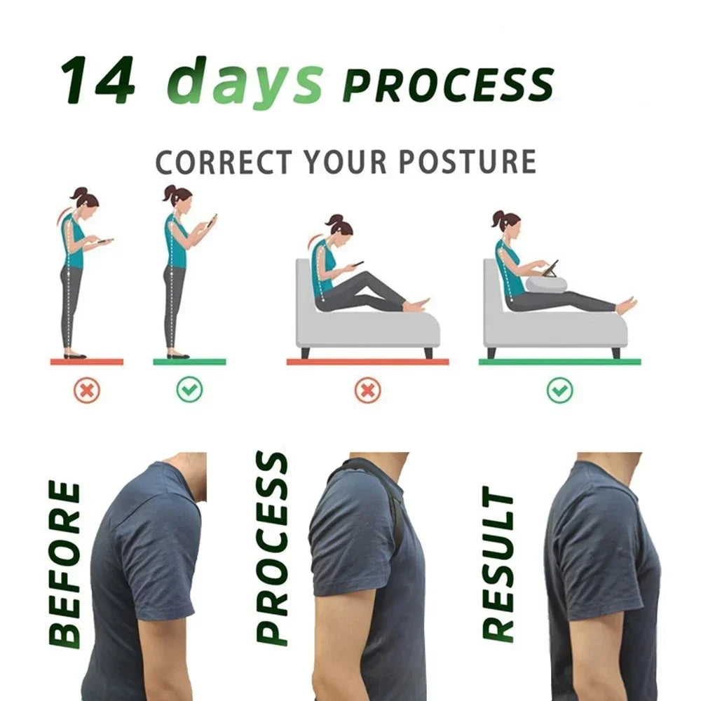 Adjustable Back Posture Corrector – Support Belt for Men & Women"